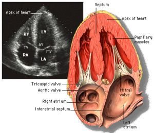 Échographie Cardiaque